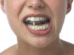 Instrumental ortodoncia